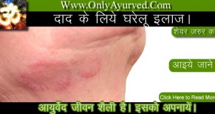 eczema treatment in hindi