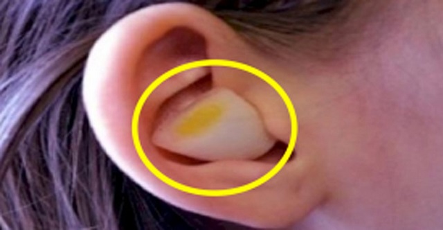 This Is What Happens When You Put An Onion In Your Ear in the night